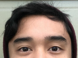 Commentary: Consider the rest